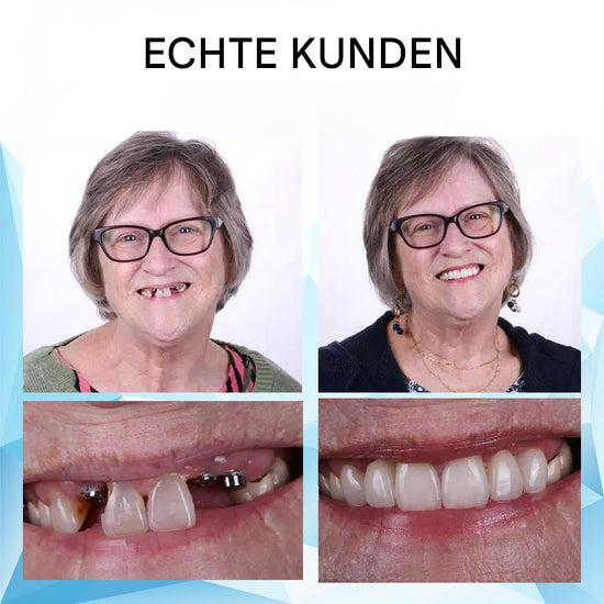 DentaFlex™ – Dein sofort perfektes Lächeln