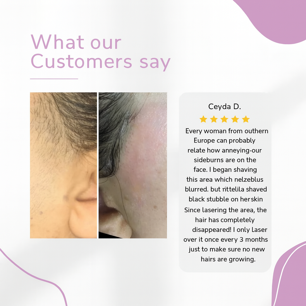 Ylvis™ - IPL Haarentfernungsgerät