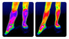 Self-heating ™ | Knee brace: quick relief from pain