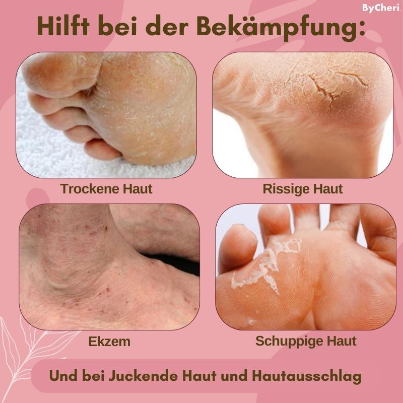 1+1 GRATIS | FootVitalize™ - Anti-Pilz Creme