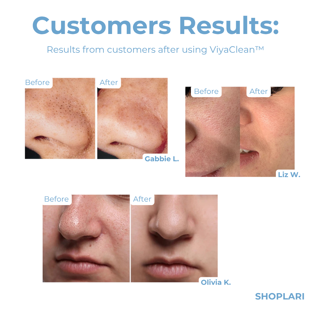 ViyaClean™ – Pore Cleansing Serum für reine Haut