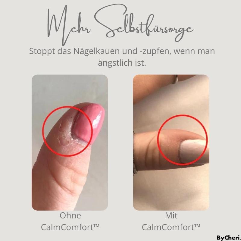 1+1 GRATIS | CalmComfort™ - Stressabbau Ring