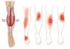 Self-heating ™ | Knee brace: quick relief from pain