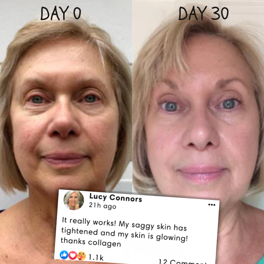 50% RABATT TEMPORÄR | RevitaMask™ | Genieße eine straffe & strahlende Haut!