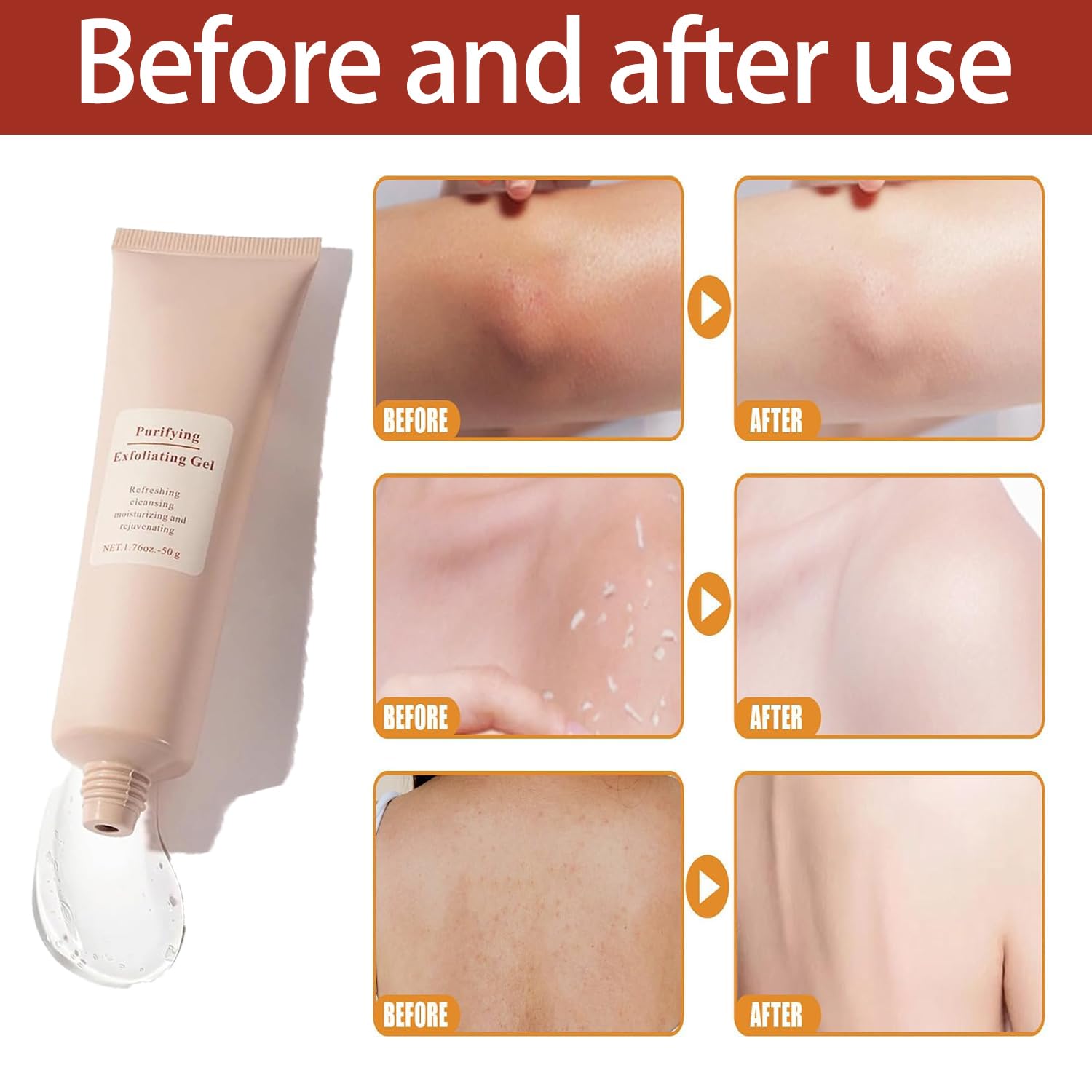 ClearSkin™ - Reinigendes Peeling-Gel