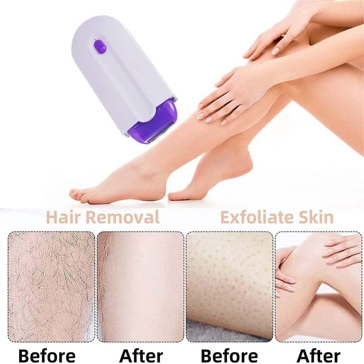 1+1 Gratis | LaserRemover™ | Schmerzfreien Haarentfernung