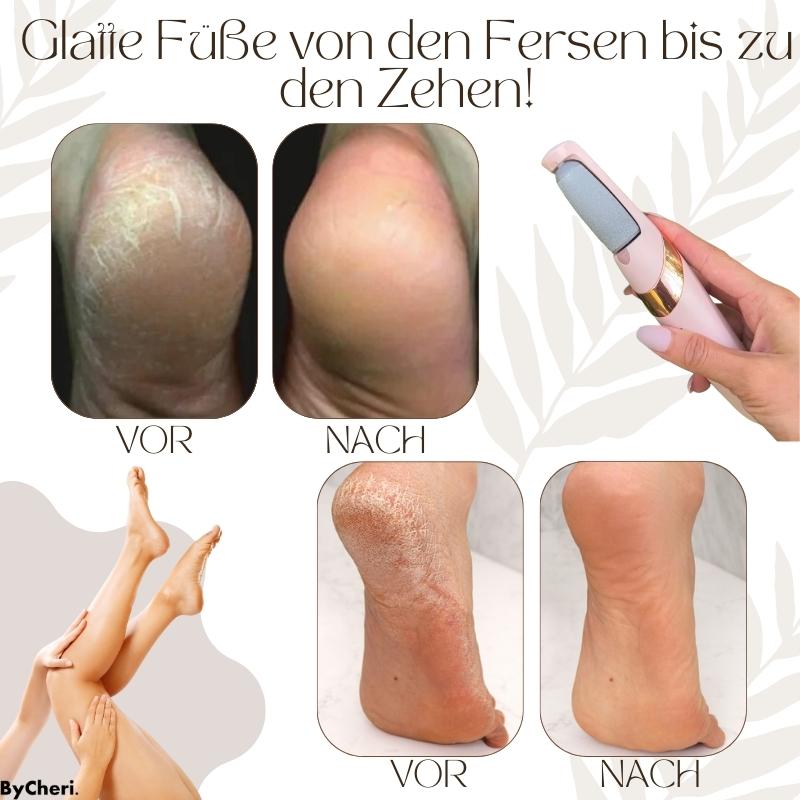 50% Rabatt temporär | CallusMaster™ - Elektrischer Hornhautzauberer