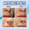 SpotClear™ | Dark Spot Vanisher in nur wenigen Wochen