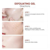 SkinExfoliate™ – Sanftes Peeling-Gel