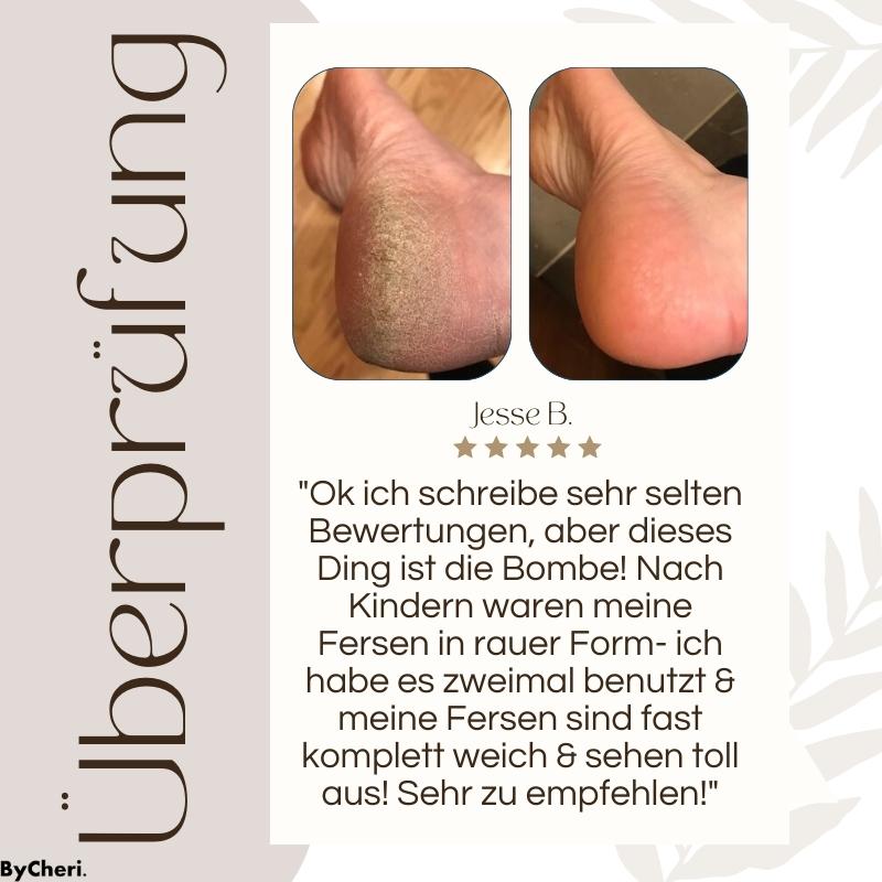 50% Rabatt temporär | CallusMaster™ - Elektrischer Hornhautzauberer