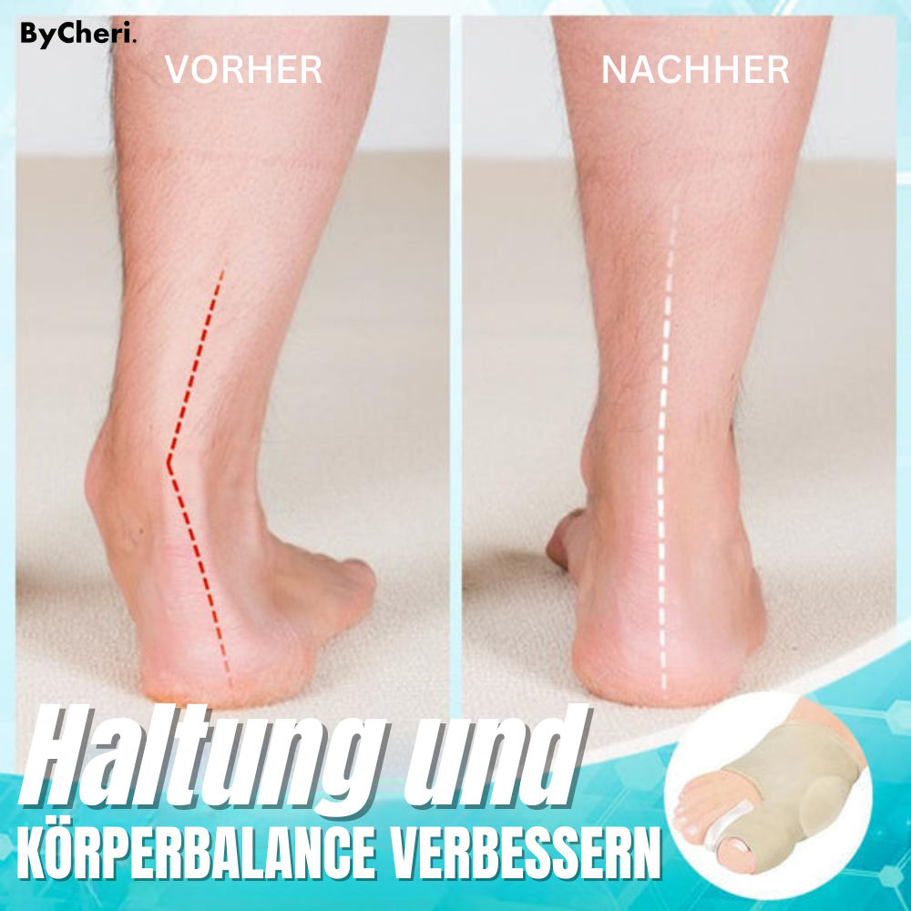 1 + 1 GRATIS | Dr. Fit™ - Hallux Valgus Korrekturhülsen für schmerzfreie