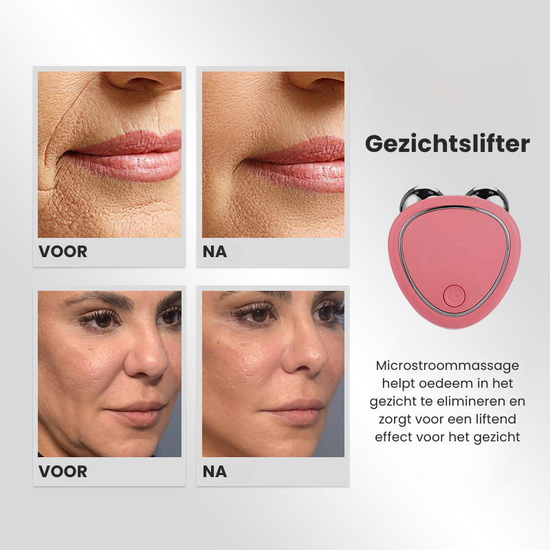 YouthNourish™ | Gesichtsmassagegerät