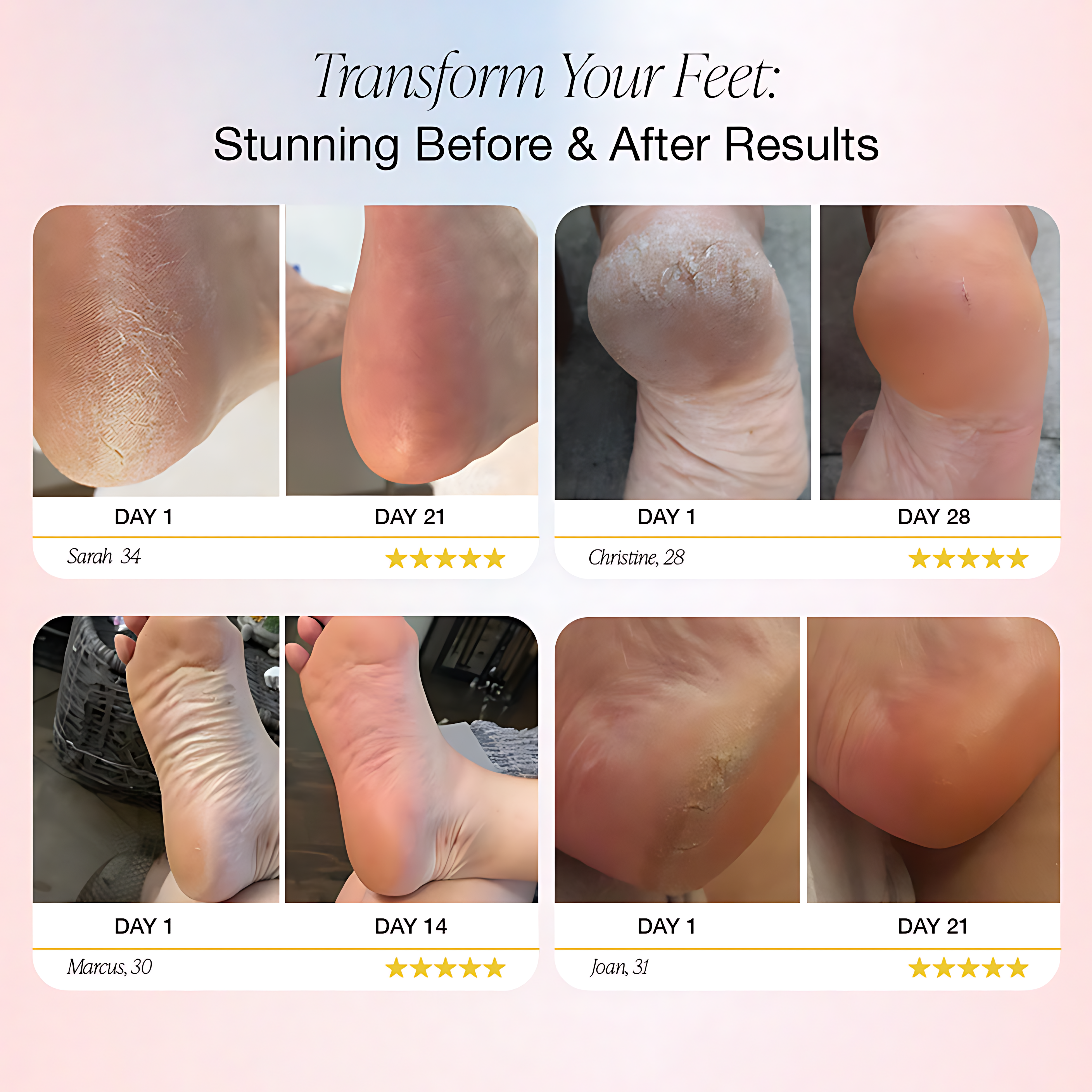 DermaVe™ – Elektrische Fußfeile