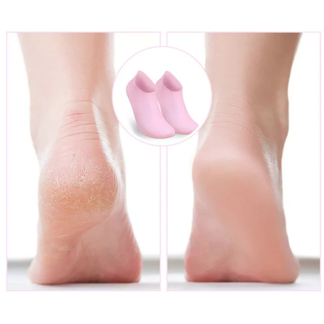 (1+1 Gratis) Feeluxe™ – Feuchtigkeitsspendende Pediküre-Socken für trockene Füße
