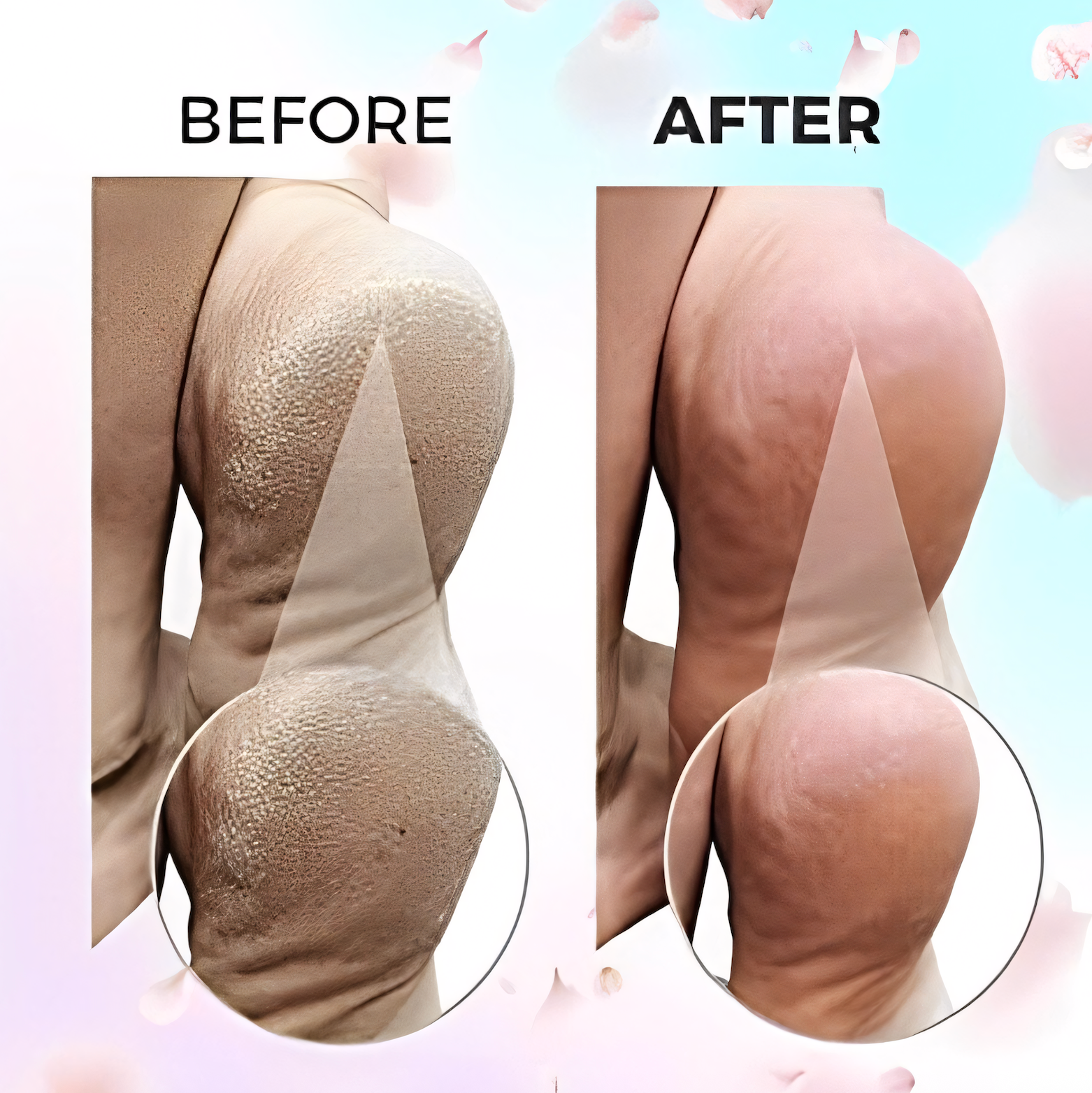 SmoothStep™ – Voor Direct Babyzachte Voeten