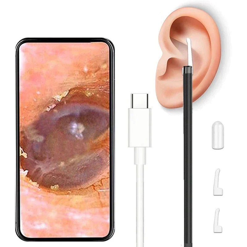 3in1 Ohrreiniger mit Kamera