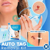 FlawFix - Stielwarzen Entfernungsset