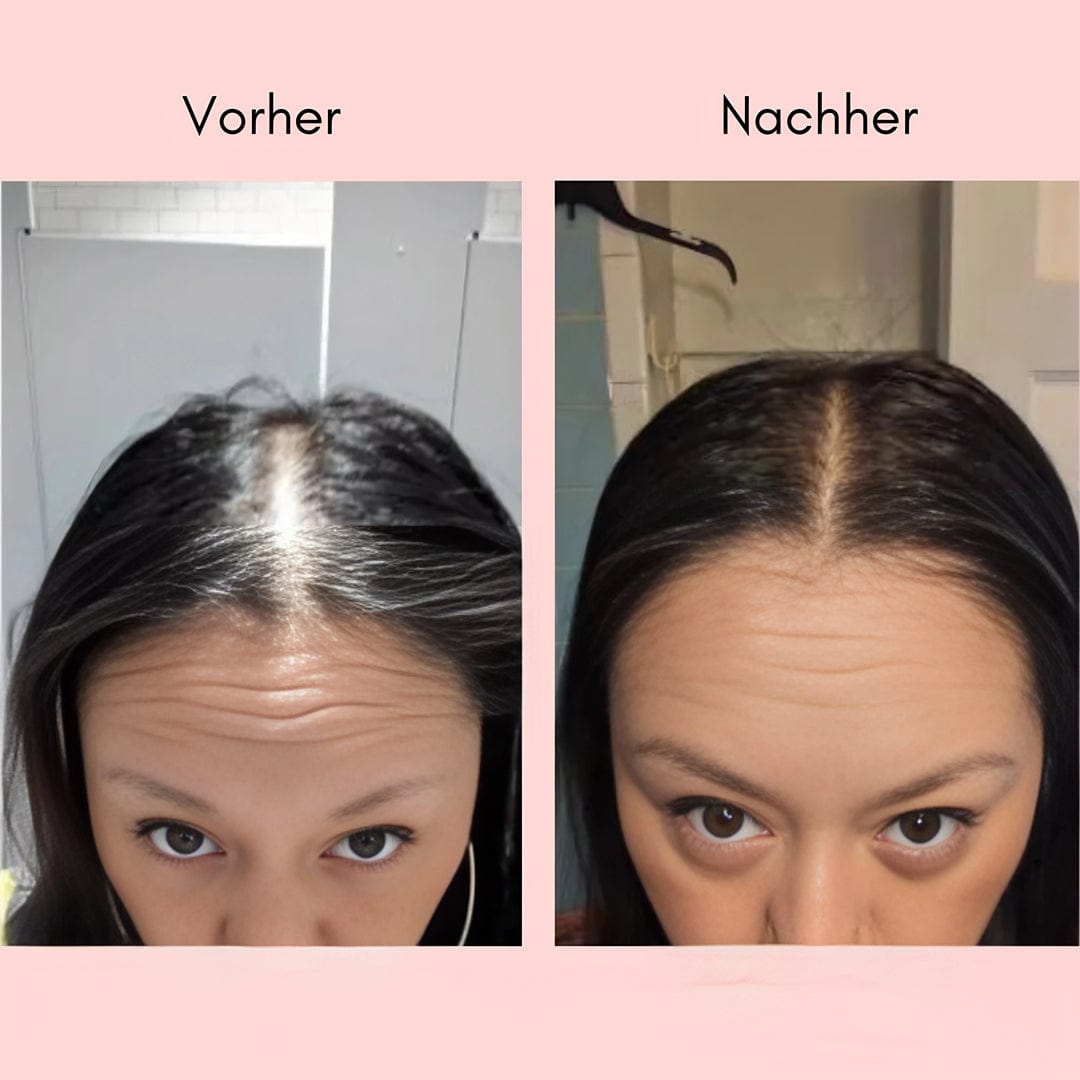 Hanna Elixir™ - Natürliches Haaröl für Wachstum
