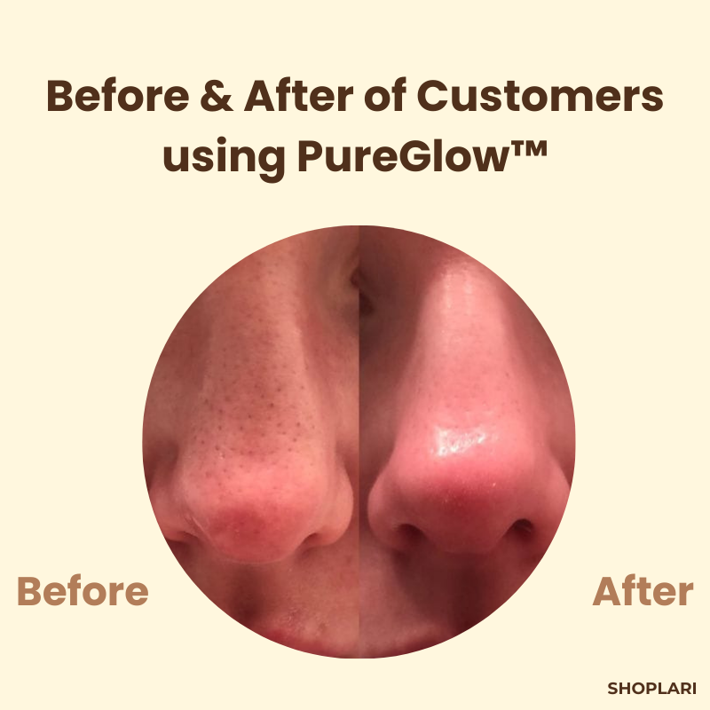 1+1 Gratis PureGlow™ Schwarzer Tee Maske