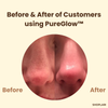 1+1 Gratis PureGlow™ Schwarzer Tee Maske
