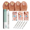 NailEssence™ | Bio-Nagelpflegestift