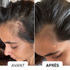 Scalpy™ | Scalp Massager with Infrared Light
