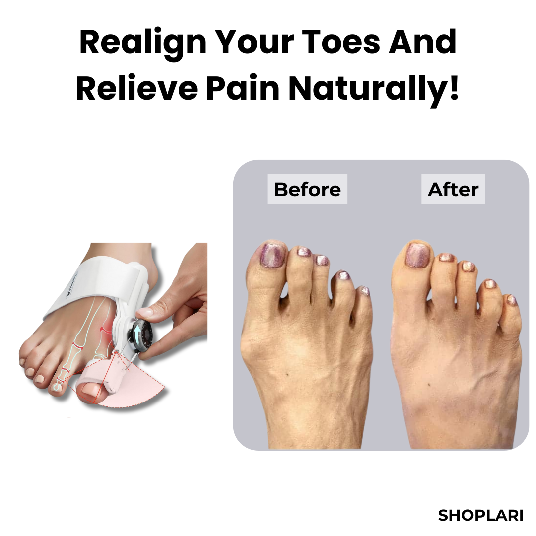 ToeAlign™ – Effektiver Hallux-Valgus-Korrektor